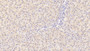 DAB staining on IHC-P; Sample: Human Liver Tissue; Primary Ab: 30ug/ml Mouse Anti-Human IL29 Antibody Second Ab: 2ug/mL HRP-Linked Caprine Anti-Mouse IgG Polyclonal Antibody