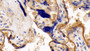 DAB staining on IHC-P; Sample: Human Placenta Tissue; Primary Ab: 20ug/ml Mouse Anti-Human CD147 Antibody; Second Ab: 2ug/mL HRP-Linked Caprine Anti-Mouse IgG Polyclonal Antibody