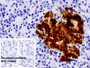 DAB staining on IHC-P; Sample: Human Pancreas Tissue; Primary Ab: 20ug/ml Mouse Anti-Human INS Antibody; Control: Used PBS instead of primary antibody; Second Ab: 2ug/ml HRP-Linked Caprine Anti-Mouse IgG Polyclonal Antibody