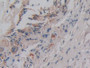 DAB staining on IHC-P; Sample: Rat Skin Tissue; Primary Ab: 30ug/ml Mouse Anti-Rat IL1a Antibody Second Ab: 2ug/mL HRP-Linked Caprine Anti-Mouse IgG Polyclonal Antibody