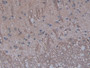 DAB staining on IHC-P; Sample: Rat Spinal cord Tissue; Primary Ab: 30ug/ml Mouse Anti-Rat IL1a Antibody; Second Ab: 2ug/mL HRP-Linked Caprine Anti-Mouse IgG Polyclonal Antibody