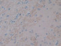 DAB staining on IHC-P; Sample: Rat Cerebrum Tissue; Primary Ab: 30ug/ml Mouse Anti-Rat IL1a Antibody; Second Ab: 2ug/mL HRP-Linked Caprine Anti-Mouse IgG Polyclonal Antibody
