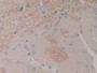 DAB staining on IHC-P; Sample: Rat Cerebrum Tissue; Primary Ab: 30ug/ml Mouse Anti-Rat IL1a Antibody; Second Ab: 2ug/mL HRP-Linked Caprine Anti-Mouse IgG Polyclonal Antibody