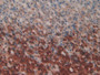 DAB staining on IHC-P; Sample: Rat Stomach Tissue; Primary Ab: 30ug/ml Mouse Anti-Rat IL1a Antibody Second Ab: 2ug/mL HRP-Linked Caprine Anti-Mouse IgG Polyclonal Antibody
