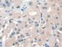 DAB staining on IHC-P; Sample: Human Stomach Tissue; Primary Ab: 30ug/ml Mouse Anti-Human EPO Antibody; Second Ab: 2ug/mL HRP-Linked Caprine Anti-Mouse IgG Polyclonal Antibody
