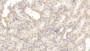 DAB staining on IHC-P; Sample: Human Kidney Tissue; Primary Ab: 30ug/ml Mouse Anti-Human MAPRE1 Antibody; Second Ab: 2ug/mL HRP-Linked Caprine Anti-Mouse IgG Polyclonal Antibody