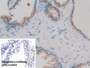 DAB staining on IHC-P; Sample: Human Kidney Tissue; Primary Ab: 30ug/ml Mouse Anti-Human MAPRE1 Antibody; Control: Used PBS instead of primary antibody; Second Ab: 2ug/ml HRP-Linked Caprine Anti-Mouse IgG Polyclonal Antibody