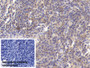 DAB staining on IHC-P; Sample: Human Spleen Tissue; Primary Ab: 30ug/ml Mouse Anti-Human MAPRE1 Antibody; Control: Used PBS instead of primary antibody; Second Ab: 2ug/ml HRP-Linked Caprine Anti-Mouse IgG Polyclonal Antibody