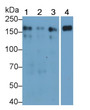 Western Blot; Sample: Lane1: Hela cell lysate; Lane2: MCF7 cell lysate; Lane3: A431 cell lysate; Lane4: Human Placenta lysate Primary Ab: 0.04ug/ml Mouse Anti-Human EGFR Antibody Second Ab: 0.2ug/mL HRP-Linked Caprine Anti-Mouse IgG Polyclonal Antibody