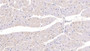 DAB staining on IHC-P; Sample: Human Cardiac Muscle Tissue; Primary Ab: 20ug/ml Mouse Anti-Human SFRP1 Antibody Second Ab: 2ug/mL HRP-Linked Caprine Anti-Mouse IgG Polyclonal Antibody