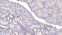 DAB staining on IHC-P; Sample: Human Kidney Tissue; Primary Ab: 20ug/ml Mouse Anti-Human SFRP1 Antibody Second Ab: 2ug/mL HRP-Linked Caprine Anti-Mouse IgG Polyclonal Antibody