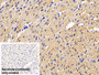 DAB staining on IHC-P; Sample: Mouse Cardiac Muscle Tissue; Primary Ab: 30ug/ml Mouse Anti-Human SFRP1 Antibody; Control: Used PBS instead of primary antibody; Second Ab: 2ug/ml HRP-Linked Caprine Anti-Mouse IgG Polyclonal Antibody