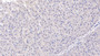 DAB staining on IHC-P; Sample: Human Liver Tissue; Primary Ab: 20ug/ml Mouse Anti-Human Visfatin Antibody Second Ab: 2ug/mL HRP-Linked Caprine Anti-Mouse IgG Polyclonal Antibody