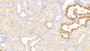 DAB staining on IHC-P; Sample: Human Kidney Tissue; Primary Ab: 20ug/ml Mouse Anti-Human a1AT Antibody Second Ab: 2ug/mL HRP-Linked Caprine Anti-Mouse IgG Polyclonal Antibody