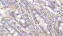 DAB staining on IHC-P; Sample: Human Small intestine Tissue; Primary Ab: 30ug/ml Mouse Anti-Human RARS Antibody Second Ab: 2ug/mL HRP-Linked Caprine Anti-Mouse IgG Polyclonal Antibody
