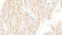 DAB staining on IHC-P; Sample: Human Cardiac Muscle Tissue; Primary Ab: 30ug/ml Mouse Anti-Human RARS Antibody; Second Ab: 2ug/mL HRP-Linked Caprine Anti-Mouse IgG Polyclonal Antibody