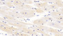 DAB staining on IHC-P; Sample: Human Cardiac Muscle Tissue; Primary Ab: 30ug/ml Mouse Anti-Human RARS Antibody Second Ab: 2ug/mL HRP-Linked Caprine Anti-Mouse IgG Polyclonal Antibody