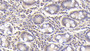 DAB staining on IHC-P; Sample: Human Small intestine Tissue; Primary Ab: 30ug/ml Mouse Anti-Human RARS Antibody; Second Ab: 2ug/mL HRP-Linked Caprine Anti-Mouse IgG Polyclonal Antibody