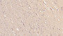 DAB staining on IHC-P; Sample: Human Cerebrum Tissue; Primary Ab: 40ug/ml Mouse Anti-Human GRIA2 Antibody Second Ab: 2ug/mL HRP-Linked Caprine Anti-Mouse IgG Polyclonal Antibody