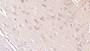 DAB staining on IHC-P; Sample: Human Cerebrum Tissue; Primary Ab: 40ug/ml Mouse Anti-Human GRIA2 Antibody Second Ab: 2ug/mL HRP-Linked Caprine Anti-Mouse IgG Polyclonal Antibody