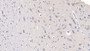 DAB staining on IHC-P; Sample: Human Cerebrum Tissue; Primary Ab: 10ug/ml Mouse Anti-Human GRIN2B Antibody Second Ab: 2ug/mL HRP-Linked Caprine Anti-Mouse IgG Polyclonal Antibody