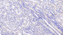 DAB staining on IHC-P; Sample: Human Kidney Tissue; Primary Ab: 20ug/ml Mouse Anti-Human Hsp60 Antibody Second Ab: 2ug/mL HRP-Linked Caprine Anti-Mouse IgG Polyclonal Antibody