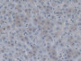 DAB staining on IHC-P; Sample: Rat Liver Tissue; Primary Ab: 20ug/ml Mouse Anti-Rat F2 Antibody Second Ab: 2ug/mL HRP-Linked Caprine Anti-Mouse IgG Polyclonal Antibody
