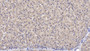 DAB staining on IHC-P; Samples: Human Liver Tissue; Primary Ab: 10ug/ml Mouse Anti-Human LEP Antibody Second Ab: 2ug/mL HRP-Linked Caprine Anti-Mouse IgG Polyclonal Antibody