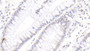 DAB staining on IHC-P; Sample: Human Colon Tissue; Primary Ab: 20ug/ml Mouse Anti-Human CDX2 Antibody; Second Ab: 2ug/mL HRP-Linked Caprine Anti-Mouse IgG Polyclonal Antibody