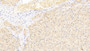 DAB staining on IHC-P; Sample: Human Liver Tissue; Primary Ab: 30ug/ml Mouse Anti-Human bACE1 Antibody Second Ab: 2ug/mL HRP-Linked Caprine Anti-Mouse IgG Polyclonal Antibody