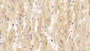DAB staining on IHC-P; Sample: Human Cardiac Muscle Tissue; Primary Ab: 30ug/ml Mouse Anti-Human SOD3 Antibody; Second Ab: 2ug/mL HRP-Linked Caprine Anti-Mouse IgG Polyclonal Antibody