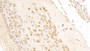 DAB staining on IHC-P; Sample: Human Placenta Tissue; Primary Ab: 10ug/ml Mouse Anti-Human HMG1 Antibody Second Ab: 2ug/mL HRP-Linked Caprine Anti-Mouse IgG Polyclonal Antibody