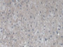 DAB staining on IHC-P; Sample: Human Liver Tissue; Primary Ab: 20ug/ml Mouse Anti-Human VEGF121 Antibody; Second Ab: 2ug/mL HRP-Linked Caprine Anti-Mouse IgG Polyclonal Antibody