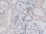 DAB staining on IHC-P; Sample: Human Kidney Tissue; Primary Ab: 30ug/ml Mouse Anti-Human VEGF121 Antibody; Second Ab: 2ug/mL HRP-Linked Caprine Anti-Mouse IgG Polyclonal Antibody