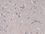 DAB staining on IHC-P; Sample: Human Cerebrum Tissue; Primary Ab: 30ug/ml Mouse Anti-Human VEGF121 Antibody Second Ab: 2ug/mL HRP-Linked Caprine Anti-Mouse IgG Polyclonal Antibody