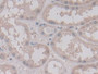 DAB staining on IHC-P; Sample: Human Kidney Tissue; Primary Ab: 30ug/ml Mouse Anti-Human VEGF121 Antibody; Second Ab: 2ug/mL HRP-Linked Caprine Anti-Mouse IgG Polyclonal Antibody