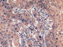DAB staining on IHC-P; Sample: Human Lymphoma Tissue; Primary Ab: 10ug/ml Mouse Anti-Human HAVCR2 Antibody; Second Ab: 2ug/mL HRP-Linked Caprine Anti-Mouse IgG Polyclonal Antibody