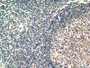 DAB staining on IHC-P; Sample: Human Tonsil Tissue; Primary Ab: 10ug/ml Mouse Anti-Human HAVCR2 Antibody Second Ab: 2ug/mL HRP-Linked Caprine Anti-Mouse IgG Polyclonal Antibody