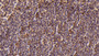 DAB staining on IHC-P; Sample: Human Spleen Tissue; Primary Ab: 30ug/ml Mouse Anti-Human PTPRC Antibody; Second Ab: 2ug/mL HRP-Linked Caprine Anti-Mouse IgG Polyclonal Antibody