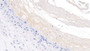 DAB staining on IHC-P; Sample: Human Placenta Tissue; Primary Ab: 10ug/ml Mouse Anti-Human PIIINP Antibody Second Ab: 2ug/mL HRP-Linked Caprine Anti-Mouse IgG Polyclonal Antibody