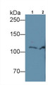 Western Blot; Sample: Lane1: Human Serum; Lane2: Human Plasma Primary Ab: 4ug/ml Mouse Anti-Human C5a Antibody Second Ab: 0.2ug/mL HRP-Linked Caprine Anti-Mouse IgG Polyclonal Antibody