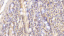 DAB staining on IHC-P; Sample: Human Small intestine Tissue; Primary Ab: 30ug/ml Mouse Anti-Human APOB Antibody Second Ab: 2ug/mL HRP-Linked Caprine Anti-Mouse IgG Polyclonal Antibody