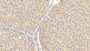 DAB staining on IHC-P; Sample: Human Liver Tissue; Primary Ab: 30ug/ml Mouse Anti-Human APOB Antibody; Second Ab: 2ug/mL HRP-Linked Caprine Anti-Mouse IgG Polyclonal Antibody