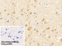 DAB staining on IHC-P; Sample: Human Cerebrum Tissue; Primary Ab: 30ug/ml Mouse Anti-Human NRGN Antibody; Control: Used PBS instead of primary antibody; Second Ab: 2ug/ml HRP-Linked Caprine Anti-Mouse IgG Polyclonal Antibody
