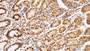 DAB staining on IHC-P; Sample: Human Stomach Tissue; Primary Ab: 10ug/ml Mouse Anti-Human HDAC1 Antibody Second Ab: 2ug/mL HRP-Linked Caprine Anti-Mouse IgG Polyclonal Antibody