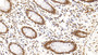 DAB staining on IHC-P; Sample: Human Rectum Tissue; Primary Ab: 10ug/ml Mouse Anti-Human HDAC1 Antibody; Second Ab: 2ug/mL HRP-Linked Caprine Anti-Mouse IgG Polyclonal Antibody
