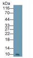 Western Blot; Sample: Human Urine Primary Ab: 1ug/ml Mouse Anti-Human RETN Antibody Second Ab: 0.2ug/mL HRP-Linked Caprine Anti-Mouse IgG Polyclonal Antibody