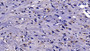DAB staining on IHC-P; Sample: Mouse Cerebrum Tissue; Primary Ab: 20ug/ml Mouse Anti-Mouse RETN Antibody Second Ab: 2ug/mL HRP-Linked Caprine Anti-Mouse IgG Polyclonal Antibody