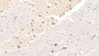 DAB staining on IHC-P; Sample: Human Cerebrum Tissue; Primary Ab: 10ug/ml Mouse Anti-Human RETN Antibody Second Ab: 2ug/mL HRP-Linked Caprine Anti-Mouse IgG Polyclonal Antibody