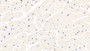 DAB staining on IHC-P; Sample: Human Cardiac Muscle Tissue; Primary Ab: 30ug/ml Mouse Anti-Human ITGa11 Antibody Second Ab: 2ug/mL HRP-Linked Caprine Anti-Mouse IgG Polyclonal Antibody